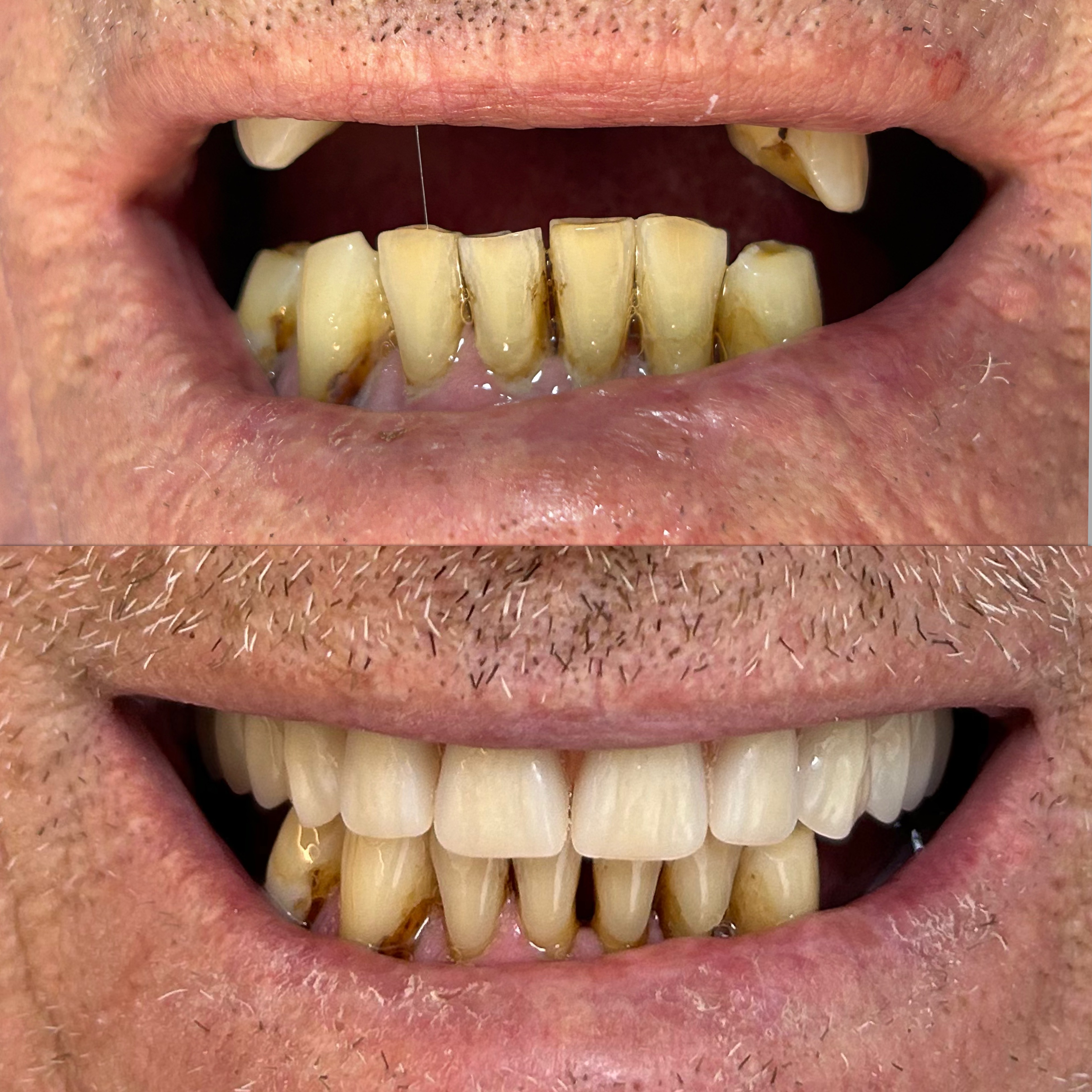 Caso clínico 4 antes e depois