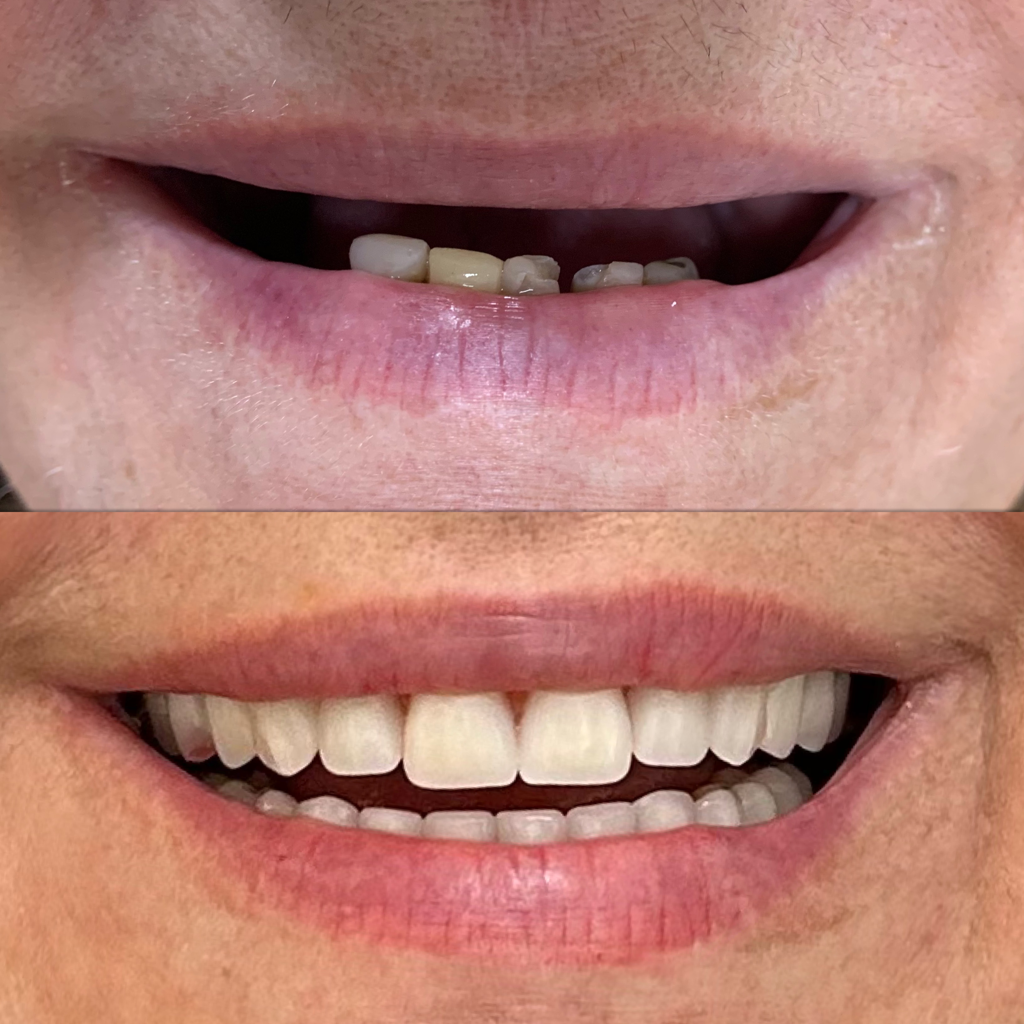 Caso clínico 6 antes e depois