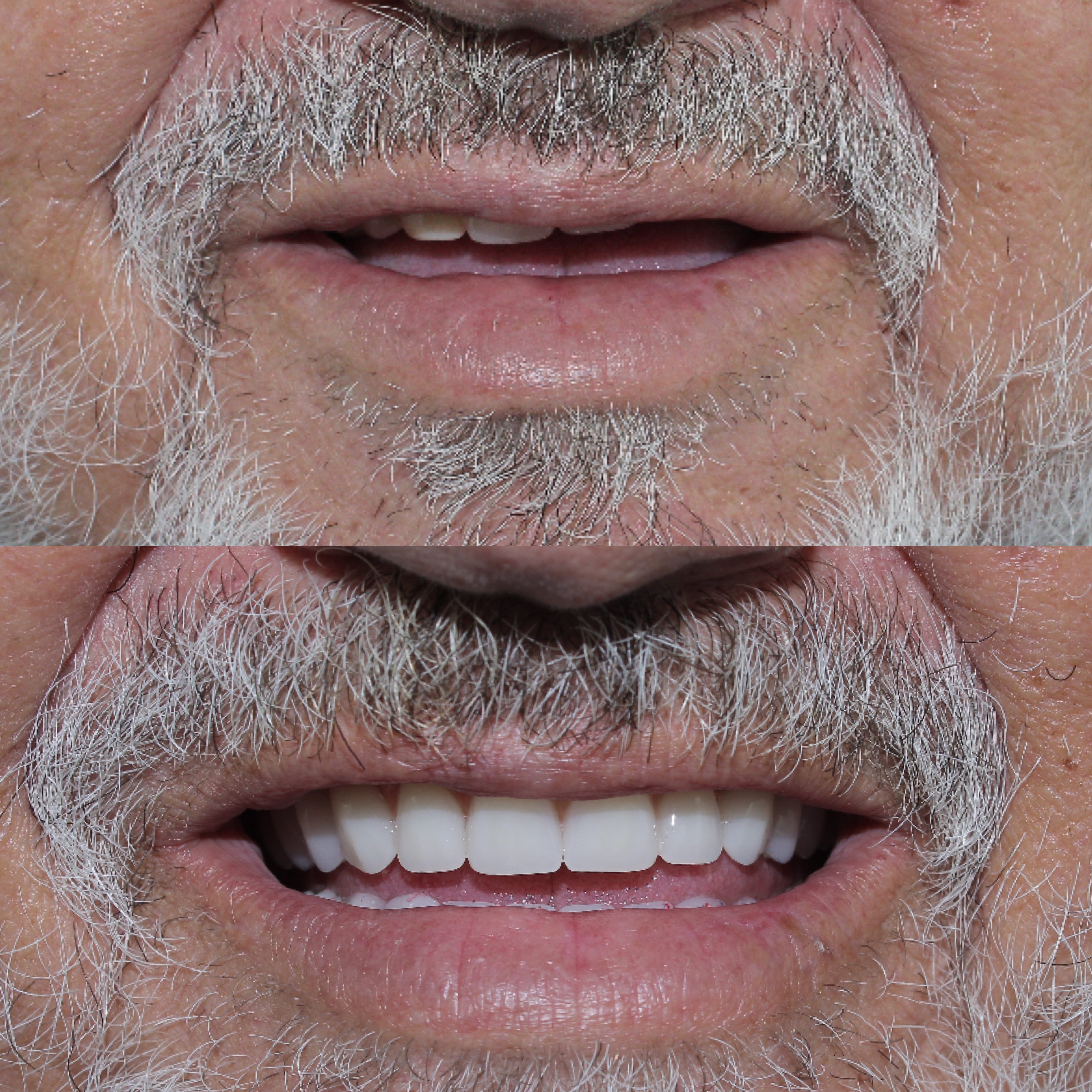 Caso clínico 7 antes e depois