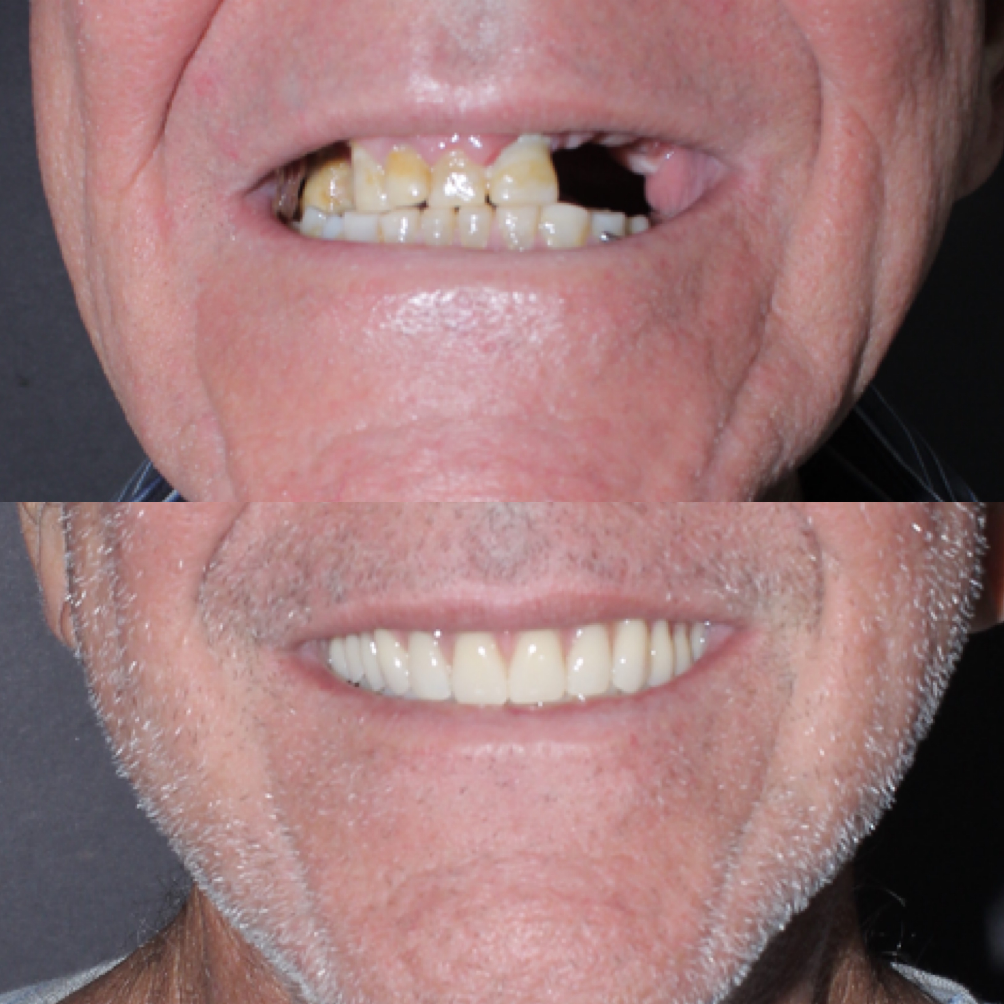 Caso clínico 8 antes e depois